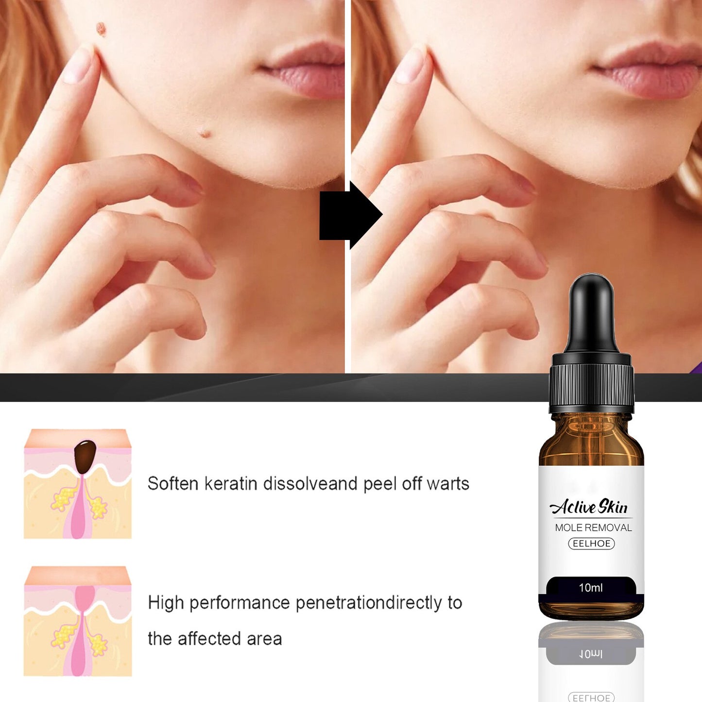 Mole Wart Serum Organic Tags Solutions No Trace Painle Skin Remover Removal Cream Painless Face Freckle Beauty 0 DailyAlertDeals