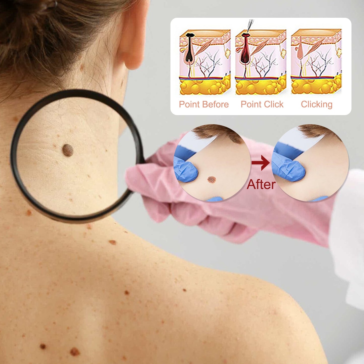 Mole Wart Serum Organic Tags Solutions No Trace Painle Skin Remover Removal Cream Painless Face Freckle Beauty 0 DailyAlertDeals