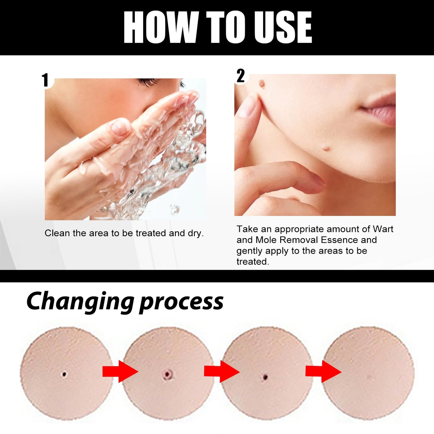 Mole Wart Serum Organic Tags Solutions No Trace Painle Skin Remover Removal Cream Painless Face Freckle Beauty 0 DailyAlertDeals