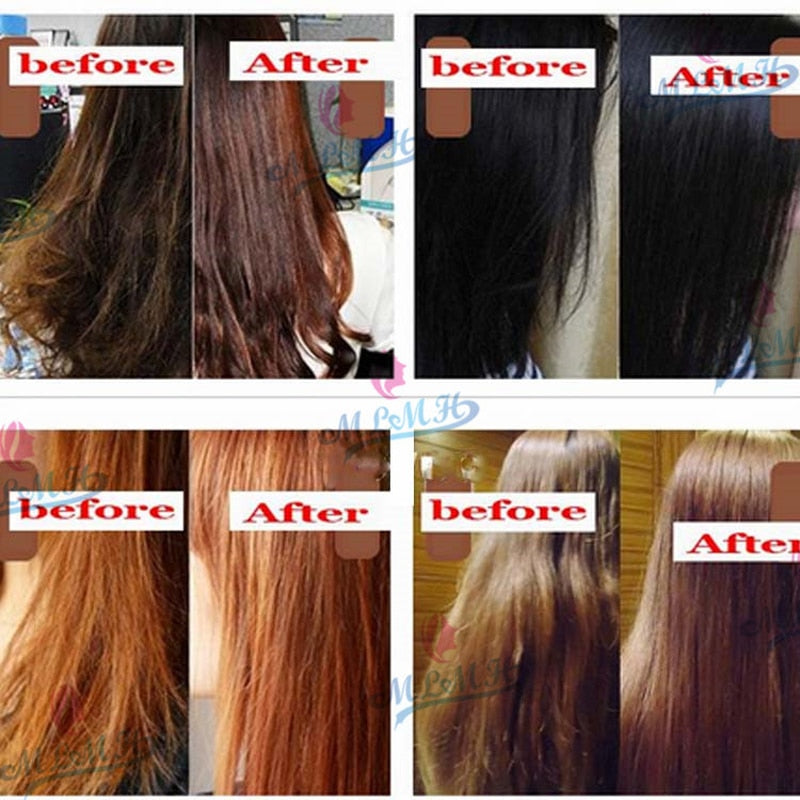 Fast Hair Growth Serum Essential Oil Ginger Anti Hair Loss Treatment Hair Nutrition Liquid Damaged Hair Repair Regrowth Products 0 DailyAlertDeals   