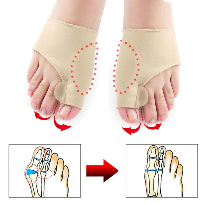 1Pair Toe Separator Hallux Valgus Bunion Corrector Foot Toe Separator Foot Thumb Corrector feet Thumb Adjuster Correction feet toe correcter DailyAlertDeals   