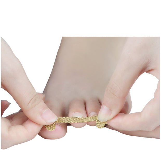 Ingrown Toenail Corrector Sticker Nail Strip Anti-roll Nail Free Glue Toe Inlay Nail Corrector Patch Correction Stickers Toenail foot nail care tool DailyAlertDeals   