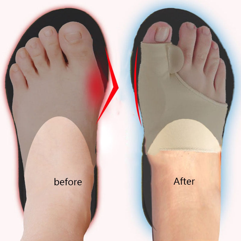 1Pair Toe Separator Hallux Valgus Bunion Corrector Foot Toe Separator Foot Thumb Corrector feet Thumb Adjuster Correction feet toe correcter DailyAlertDeals   
