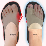 Big Toe Splint Separator Hallux Valgus Bunion Corrector Orthotic Feet Care Thumb Adjuster Correction Pedicure Socks Straightener 0 DailyAlertDeals   