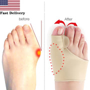 Big Toe Splint Separator Hallux Valgus Bunion Corrector Orthotic Feet Care Thumb Adjuster Correction Pedicure Socks Straightener 0 DailyAlertDeals Default Title  
