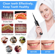 Electric Teeth whitener Scaler Teeth Whitening kit Tools Tartar Stain Remover Teeth Plague Cleaner Tooth Scaling Supplies Teeth Brush Cleaner DailyAlertDeals   