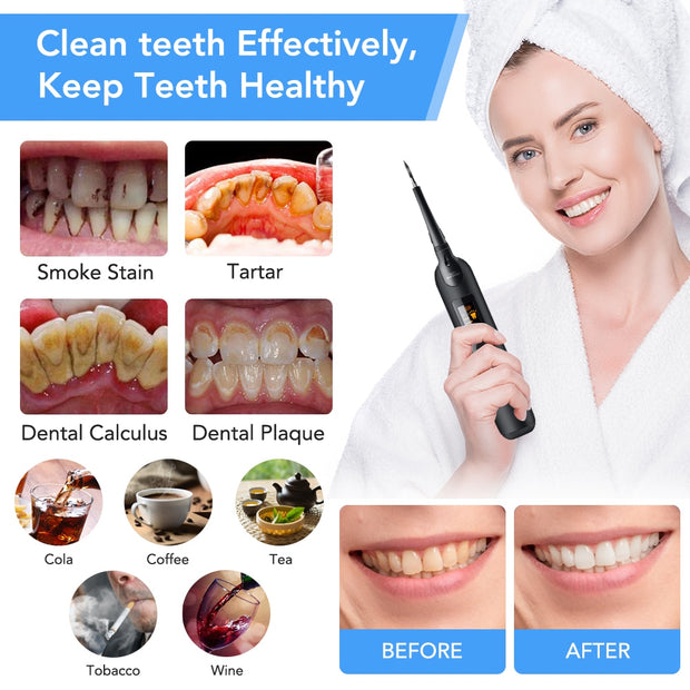 Electric Teeth whitener Scaler Teeth Whitening kit Teeth Plague Cleaner Stain Tartar Remover Tooth Whitening Supplies teeth Cleaner tartar remover DailyAlertDeals   