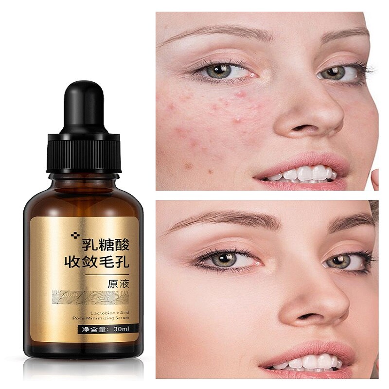 Natural Organic Facial Whitening Lactobionic Acid Anti Wrinkle Anti Aging Minimizing Pores Serum Skin Care Face Solution Essence 0 DailyAlertDeals   