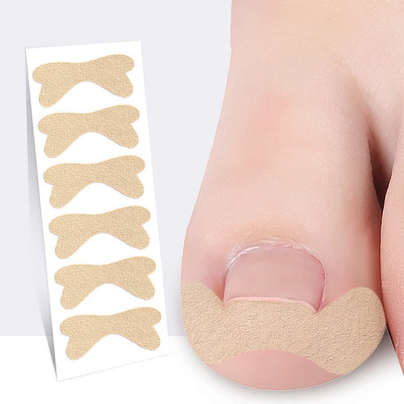 Ingrown Toenail Corrector Sticker Nail Strip Anti-roll Nail Free Glue Toe Inlay Nail Corrector Patch Correction Stickers Toenail foot nail care tool DailyAlertDeals 6PCS G179  