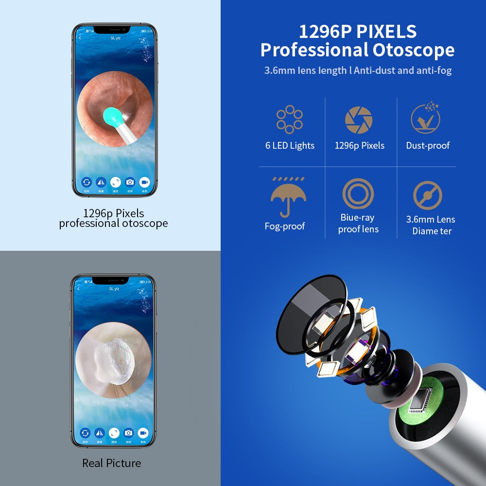 NE3 Ear Cleaner High Precision Ear Wax Removal Tool with Camera LED Light Wireless Otoscope Smart Ear Cleaning Kit ear cleaner DailyAlertDeals   
