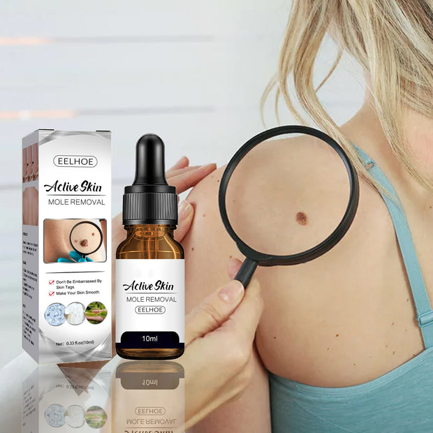 Mole Wart Serum Organic Tags Solutions No Trace Painle Skin Remover Removal Cream Painless Face Freckle Beauty 0 DailyAlertDeals   