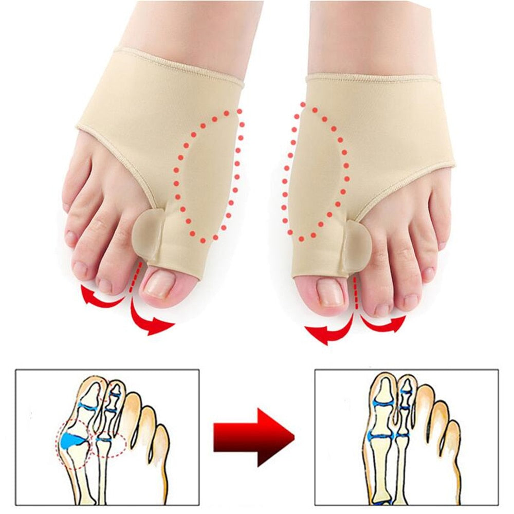 1Pair Toe Separator Hallux Valgus Bunion Corrector Hammer Toe Straightener Foot Pain Relief Orthopedic Pedicure Tools Foot Care 0 DailyAlertDeals China  