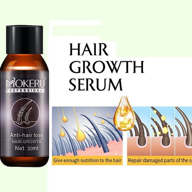 Mokeru 1pc 30ml Natural organic castor oil tonic essence hair loss  hozanas4life   