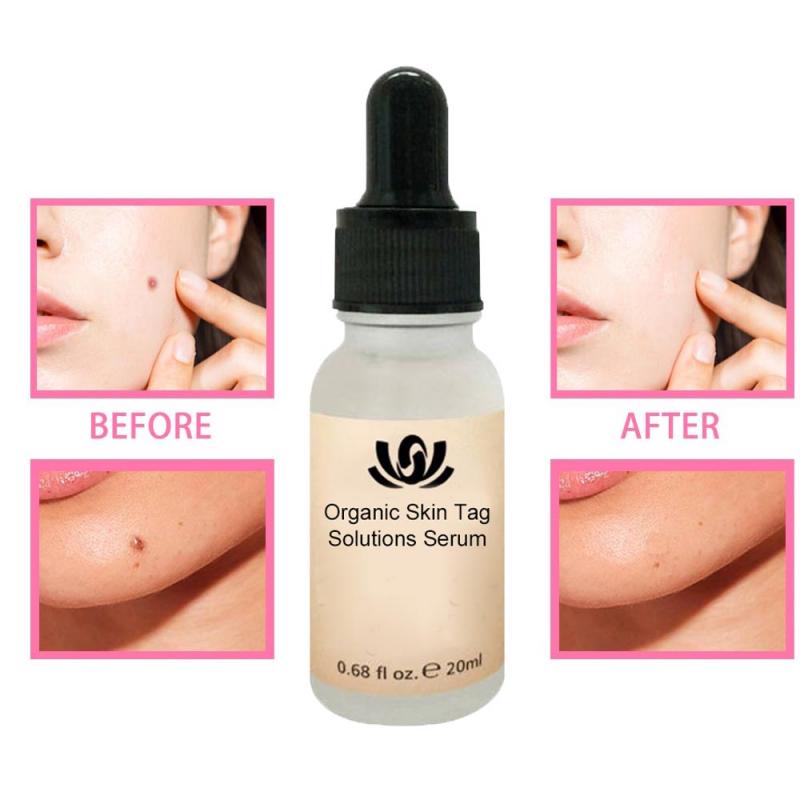 20ml Organic Tags Solutions Serum Rose Cleansing Essential  hozanas4life   