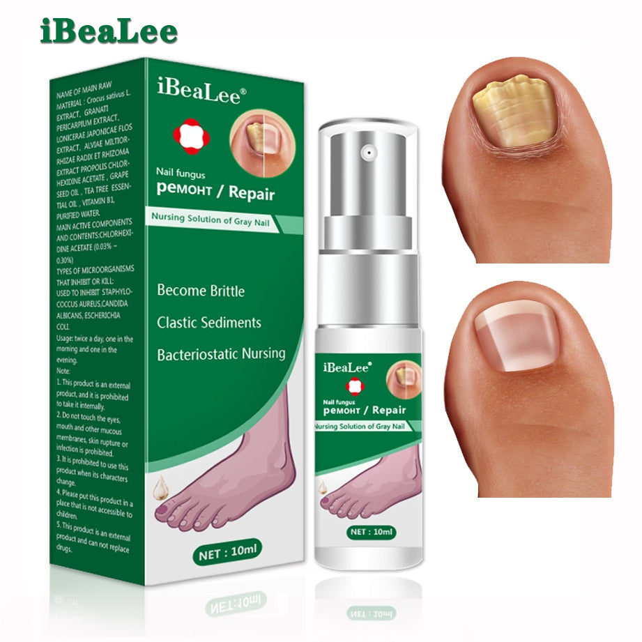 Nail Fungus Treatment Feet Care Essence Nails Foot Repair  hozanas4life   