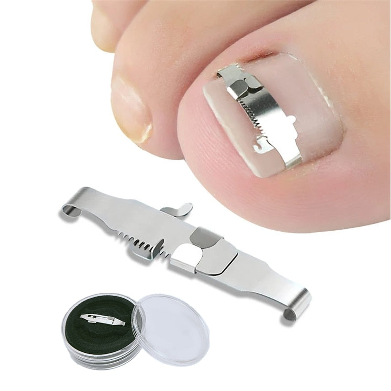 Ingrown toenail corrector Tools Pedicure Recover Embed Toe Nail  hozanas4life   