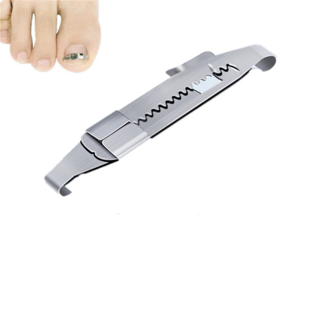 Ingrown toenail corrector Tools Pedicure Recover Embed Toe Nail  hozanas4life China siliver S 