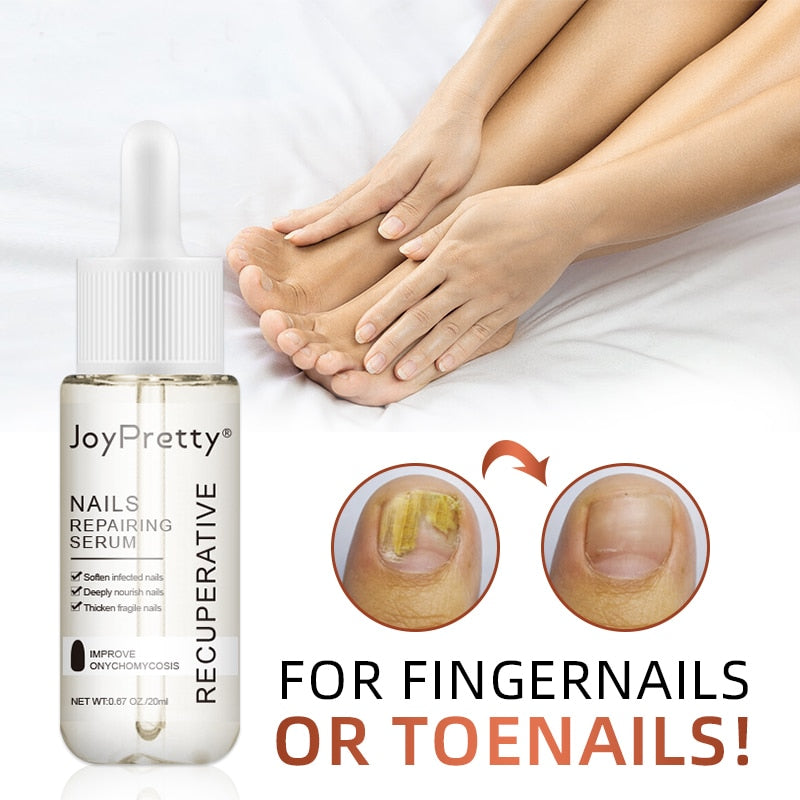 Fungal Finger and Toe Nail Treatment oil Serum Foot Repair Nails Essence Care oil  hozanas4life   