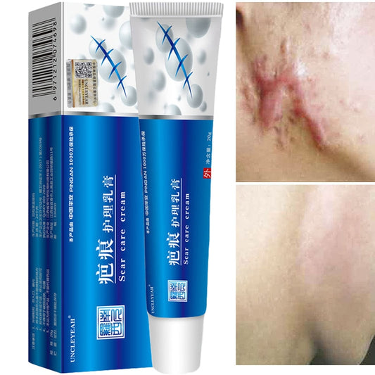 Acne Scar Removal Cream Pimples Stretch Marks Face Gel Remove Acne Smoothing  hozanas4life   